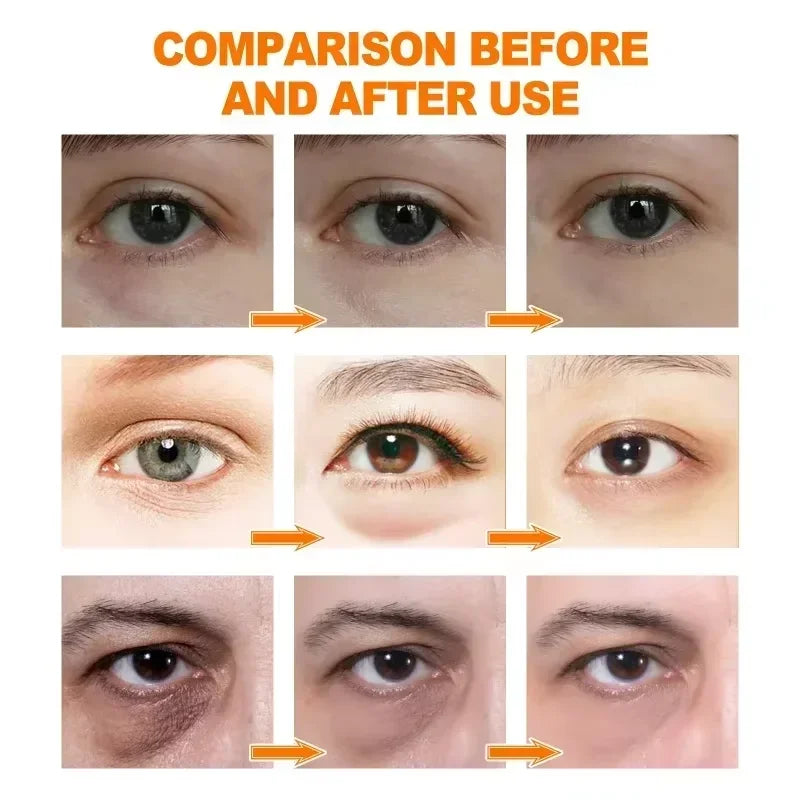 Anti Dark Circle Eye Serum Oil Retinol Anti Wrinkle.